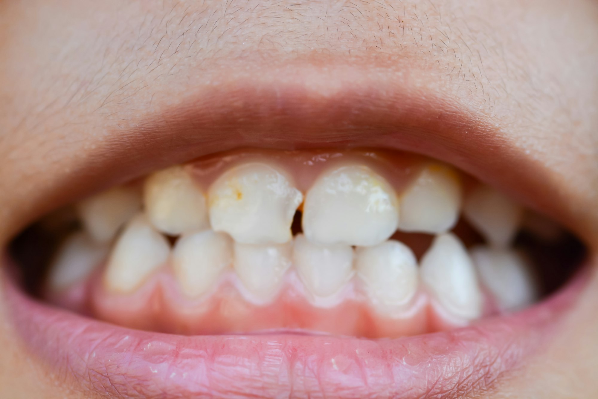 Childrendentistry