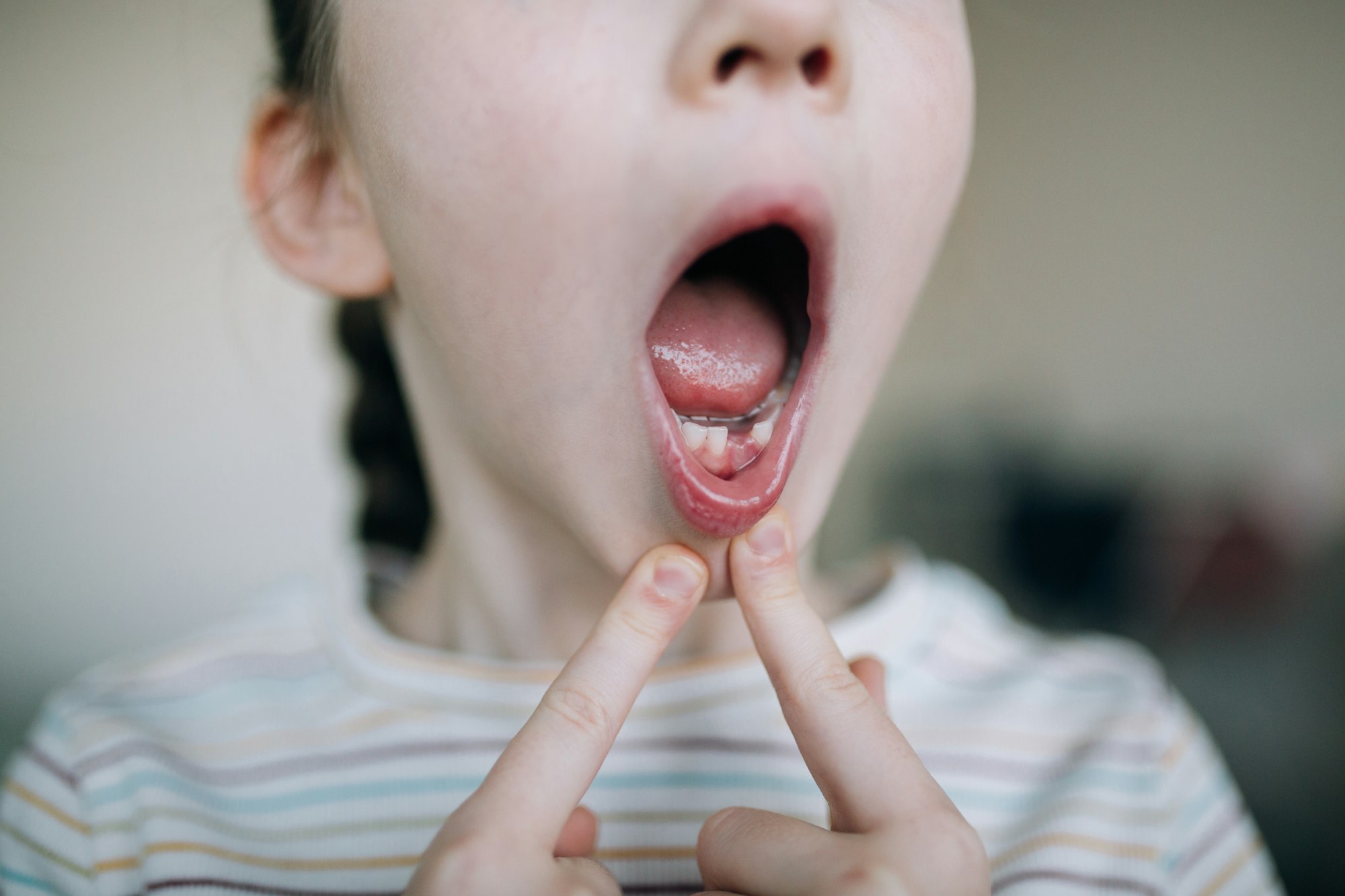 Emergency Childrendentist in Beverly Hills