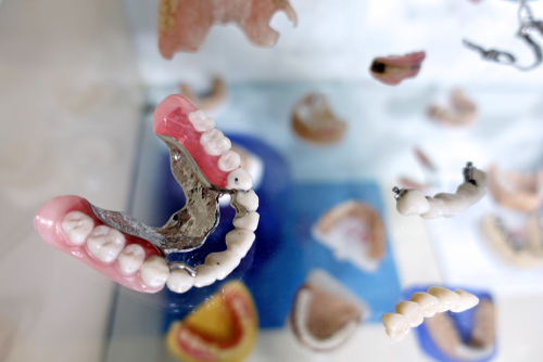 Pediatric zirconia crowns in Beverly Hills by Dr. Sepehr Nassiripour, DDS