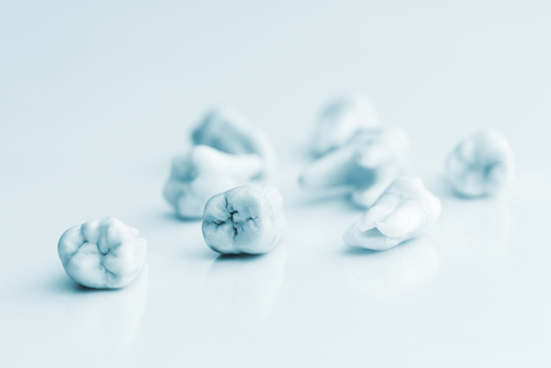 Tooth-colored fillings in Beverly Hills by Dr. Sepehr Nassiripour, DDS