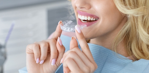 Invisalign for teens and adults in Beverly Hills by Dr. Sepehr Nassiripour, DDS