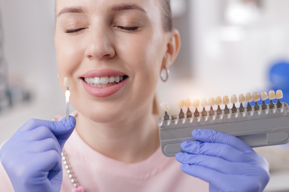 Porcelain veneers in Beverly Hills by Dr. Sepehr Nassiripour, DDS